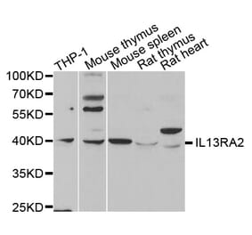 Western blot - IL13RA2 antibody from Signalway Antibody (38341) - Antibodies.com