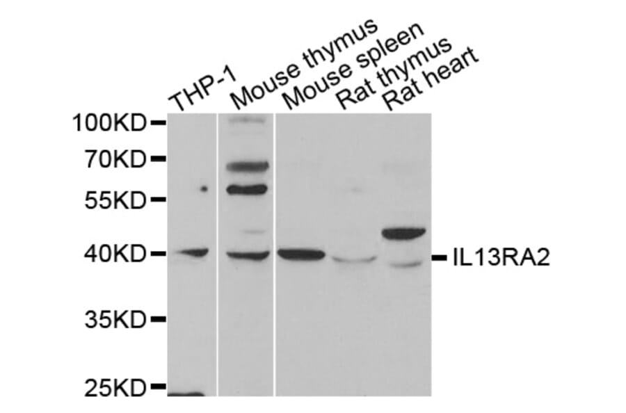 Western blot - IL13RA2 antibody from Signalway Antibody (38341) - Antibodies.com