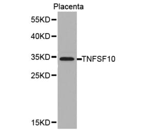 Western blot - TNFSF10 antibody from Signalway Antibody (38378) - Antibodies.com