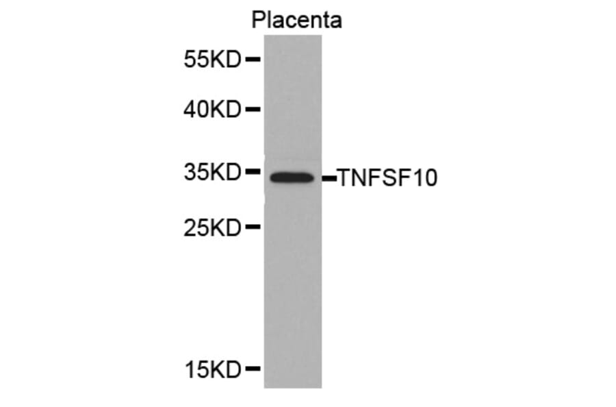 Western blot - TNFSF10 antibody from Signalway Antibody (38378) - Antibodies.com