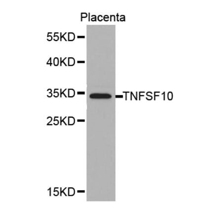 Western blot - TNFSF10 antibody from Signalway Antibody (38378) - Antibodies.com