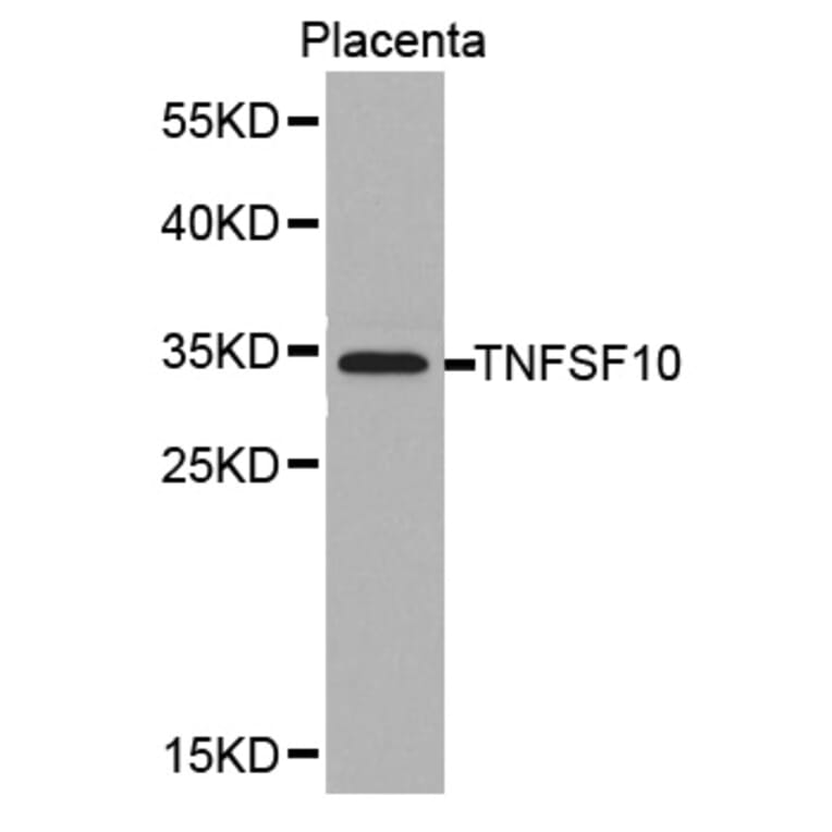 Western blot - TNFSF10 antibody from Signalway Antibody (38378) - Antibodies.com
