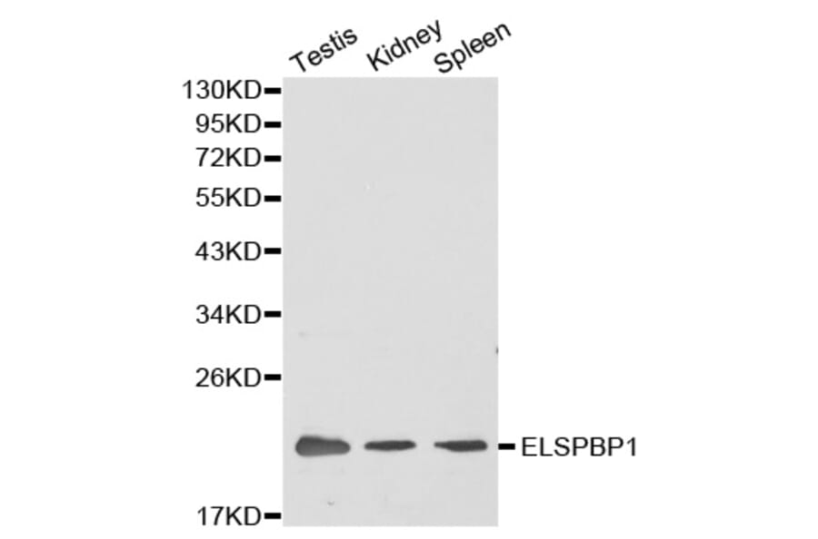 Western blot - ELSPBP1 antibody from Signalway Antibody (38383) - Antibodies.com