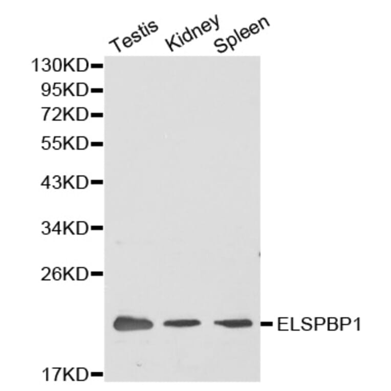 Western blot - ELSPBP1 antibody from Signalway Antibody (38383) - Antibodies.com