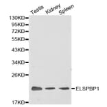 Western blot - ELSPBP1 antibody from Signalway Antibody (38383) - Antibodies.com