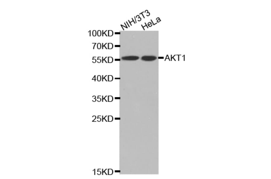 Western blot - pan-AKT antibody from Signalway Antibody (38602) - Antibodies.com