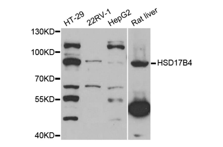 Western blot - HSD17B4 antibody from Signalway Antibody (38741) - Antibodies.com