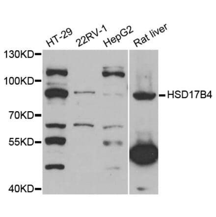 Western blot - HSD17B4 antibody from Signalway Antibody (38741) - Antibodies.com