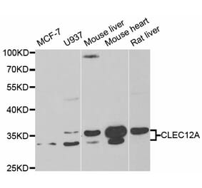 Western blot - CLEC12A antibody from Signalway Antibody (38776) - Antibodies.com