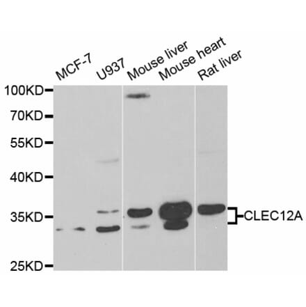 Western blot - CLEC12A antibody from Signalway Antibody (38776) - Antibodies.com