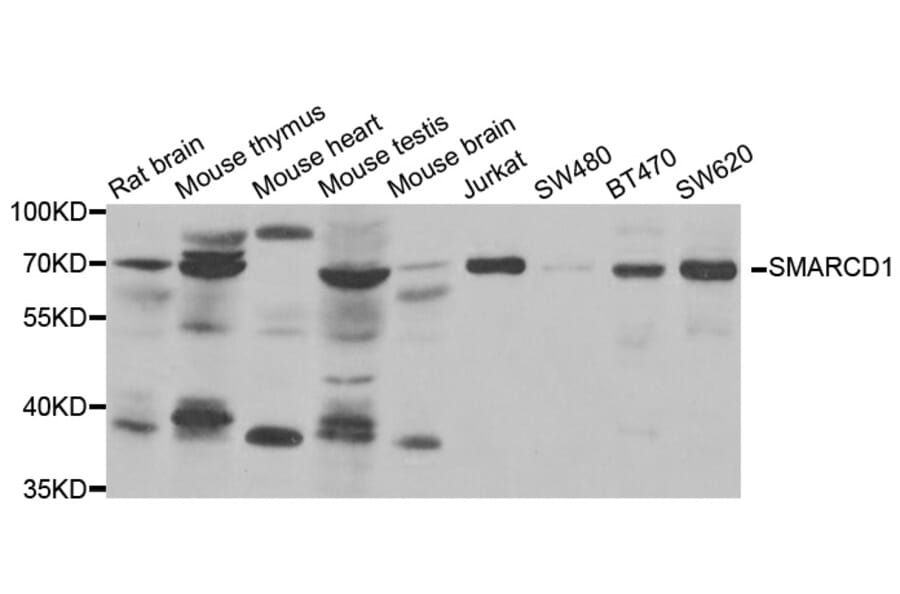 Western blot - SMARCD1 antibody from Signalway Antibody (38814) - Antibodies.com