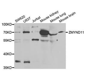 Western blot - ZMYND11 antibody from Signalway Antibody (38827) - Antibodies.com