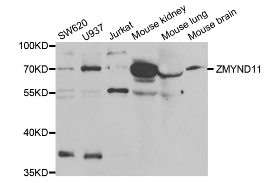 Western blot - ZMYND11 antibody from Signalway Antibody (38827) - Antibodies.com