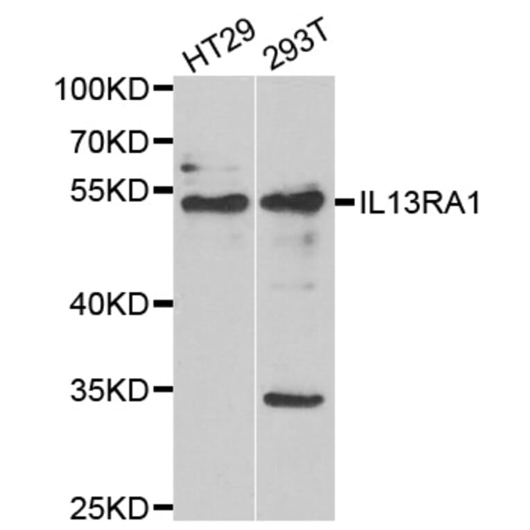 Western blot - IL13RA1 antibody from Signalway Antibody (39055) - Antibodies.com