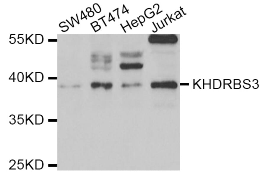 Western blot - KHDRBS3 antibody from Signalway Antibody (39062) - Antibodies.com