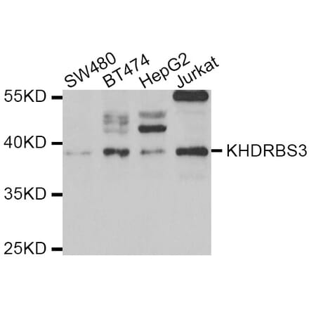 Western blot - KHDRBS3 antibody from Signalway Antibody (39062) - Antibodies.com