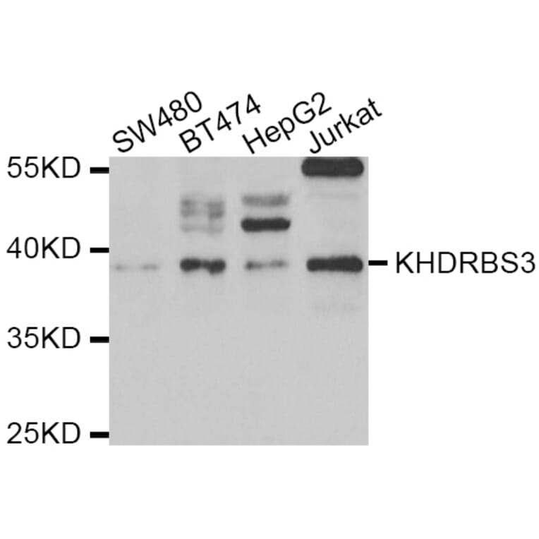 Western blot - KHDRBS3 antibody from Signalway Antibody (39062) - Antibodies.com