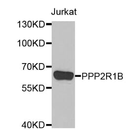 Western blot - PPP2R1B antibody from Signalway Antibody (39116) - Antibodies.com