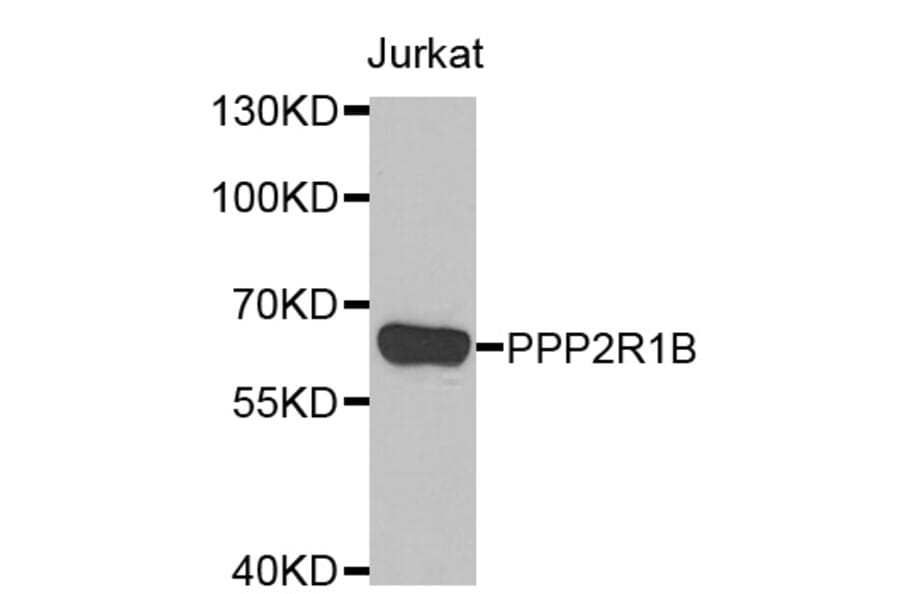 Western blot - PPP2R1B antibody from Signalway Antibody (39116) - Antibodies.com