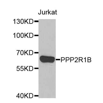 Western blot - PPP2R1B antibody from Signalway Antibody (39116) - Antibodies.com