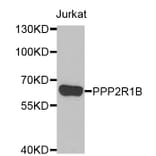 Western blot - PPP2R1B antibody from Signalway Antibody (39116) - Antibodies.com