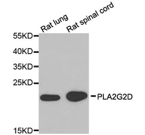 Western blot - PLA2G2D antibody from Signalway Antibody (39187) - Antibodies.com
