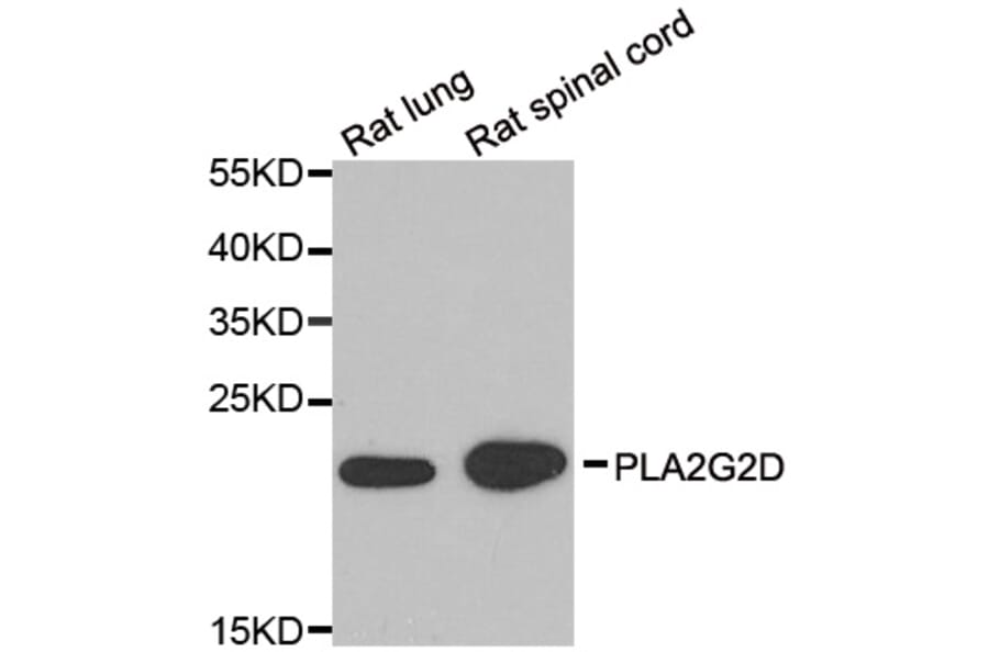 Western blot - PLA2G2D antibody from Signalway Antibody (39187) - Antibodies.com