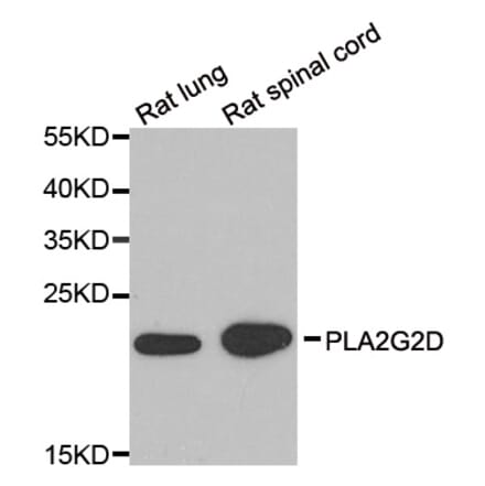 Western blot - PLA2G2D antibody from Signalway Antibody (39187) - Antibodies.com