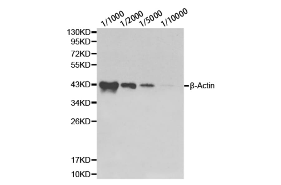 Western blot - β-actin antibody from Signalway Antibody (39199) - Antibodies.com