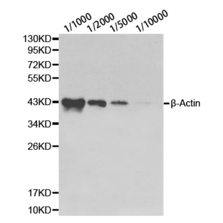 Western blot - β-actin antibody from Signalway Antibody (39199) - Antibodies.com