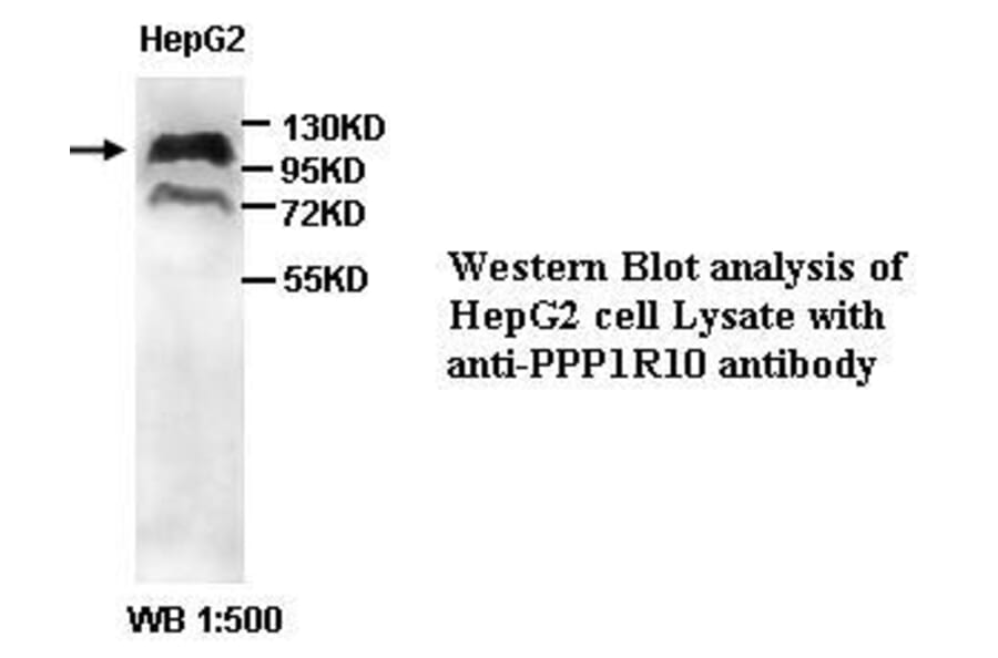 PPP1R10 Antibody from Signalway Antibody (39402) - Antibodies.com