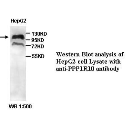 PPP1R10 Antibody from Signalway Antibody (39402) - Antibodies.com