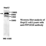 PPP1R10 Antibody from Signalway Antibody (39402) - Antibodies.com