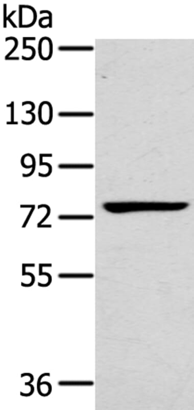 Gel: 6%SDS-PAGE Lysate: 40ug A431 cell. Primary antibody: 1/200 dilution Secondary antibody dilution: 1/8000Exposure time: 1 minute