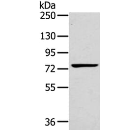 RHOBTB1 Antibody from Signalway Antibody (40075) - Antibodies.com