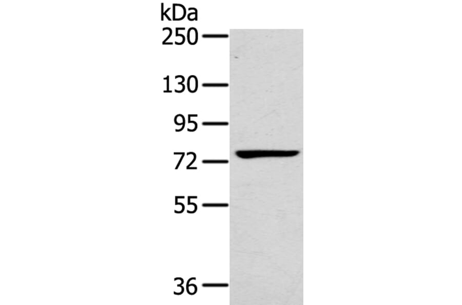 RHOBTB1 Antibody from Signalway Antibody (40075) - Antibodies.com