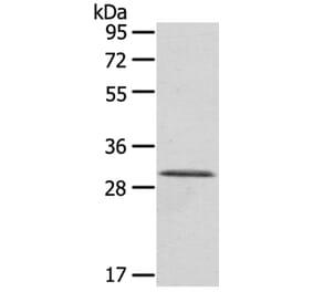 HTATIP2 Antibody from Signalway Antibody (40151) - Antibodies.com