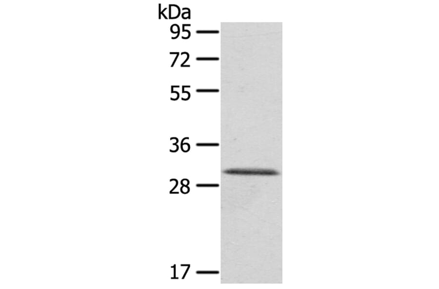HTATIP2 Antibody from Signalway Antibody (40151) - Antibodies.com
