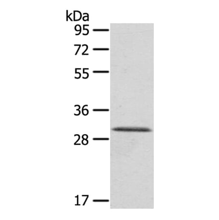HTATIP2 Antibody from Signalway Antibody (40151) - Antibodies.com