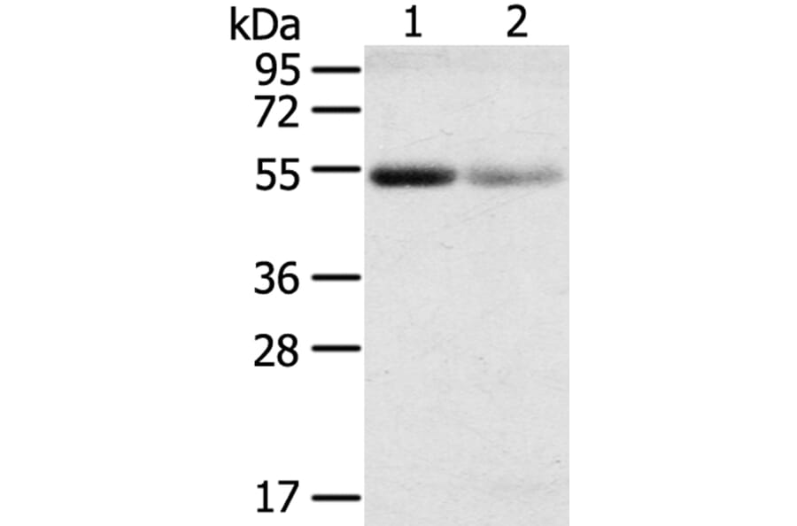 SLC17A1 Antibody from Signalway Antibody (40216) - Antibodies.com