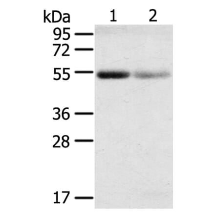 SLC17A1 Antibody from Signalway Antibody (40216) - Antibodies.com