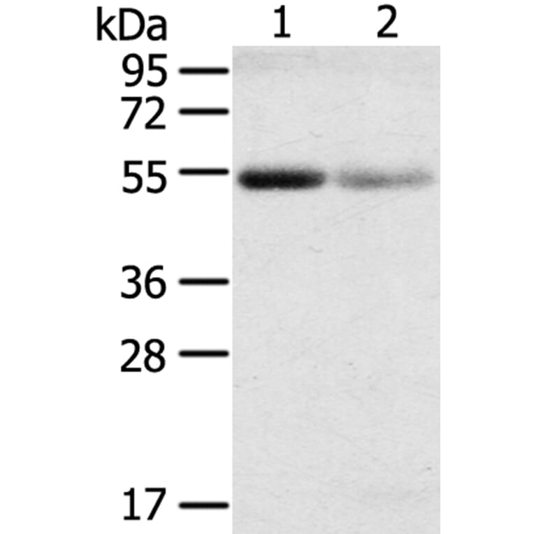 SLC17A1 Antibody from Signalway Antibody (40216) - Antibodies.com