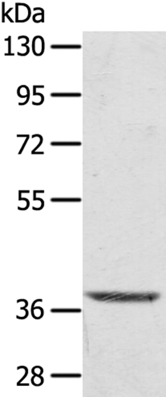 Gel: 8% SDS-PAGE Lysate: 40ug Hepg2 cell. Primary antibody: 1/300 dilution Secondary antibody dilution: 1/8000Exposure time: 10 seconds