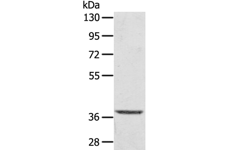 TBC1D21 Antibody from Signalway Antibody (40238) - Antibodies.com