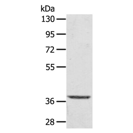 TBC1D21 Antibody from Signalway Antibody (40238) - Antibodies.com