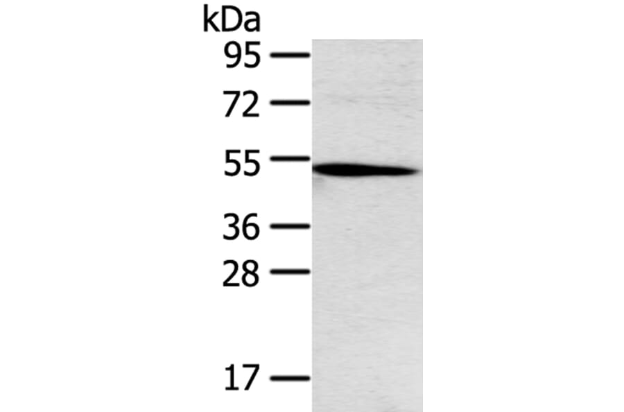 TNFRSF4 Antibody from Signalway Antibody (40256) - Antibodies.com