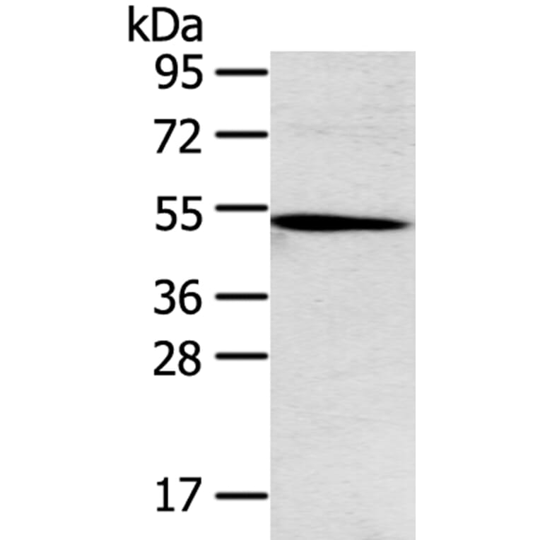 TNFRSF4 Antibody from Signalway Antibody (40256) - Antibodies.com