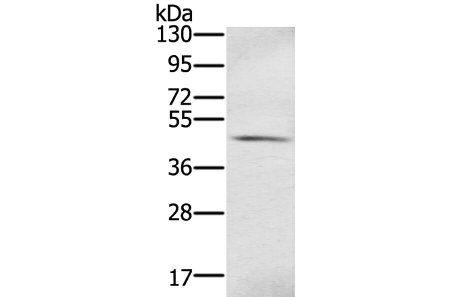 S100PBP Antibody from Signalway Antibody (40329) - Antibodies.com
