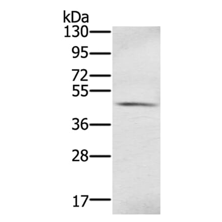 S100PBP Antibody from Signalway Antibody (40329) - Antibodies.com