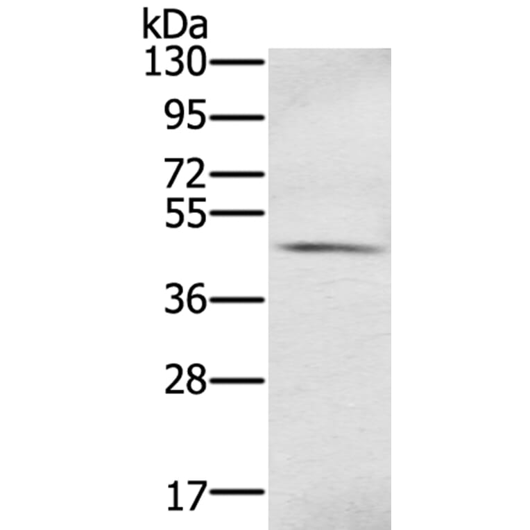 S100PBP Antibody from Signalway Antibody (40329) - Antibodies.com